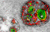 See the first color images produced by an electron microscope